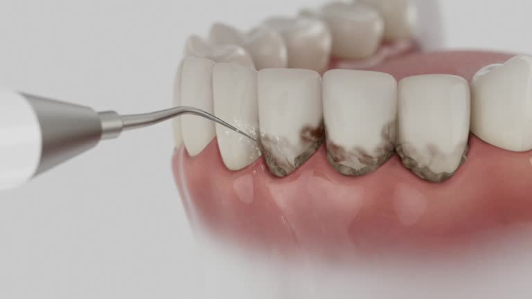 Reliable Dental contractor in Bellevue, OH by Dentist Open Now